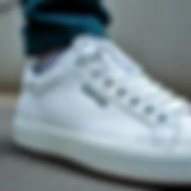 A close-up of Superga's unique design elements